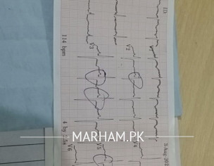 Heart Disease 