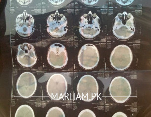 Brain Problem