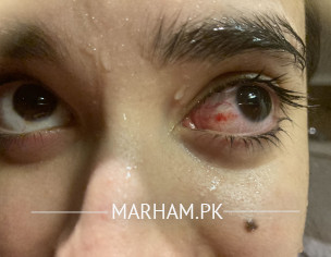 EYE SPECIALIST 