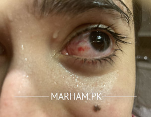 EYE SPECIALIST 