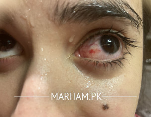 EYE SPECIALIST 