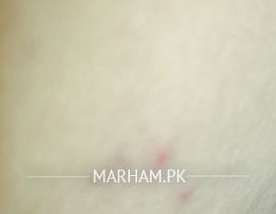 Skin Problem