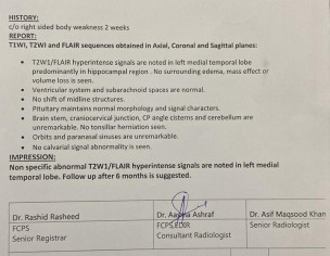Brain MRI Result