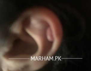 Piercing Bump