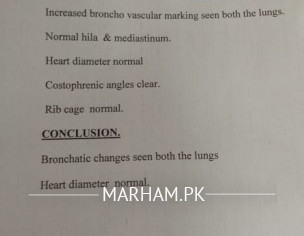 Fluid In Lungs 