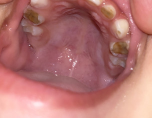 Dental Issue