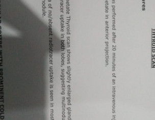 Thyroid Issue