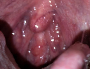 Throat Problem
