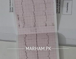 CKD