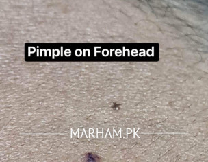 Skin Problem