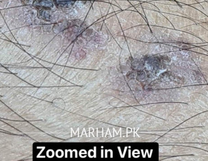 Skin Problem