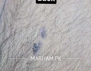 Skin Problem