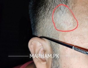 White Patch