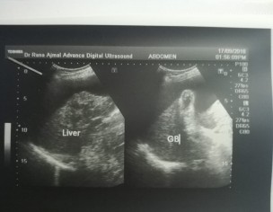 Liver