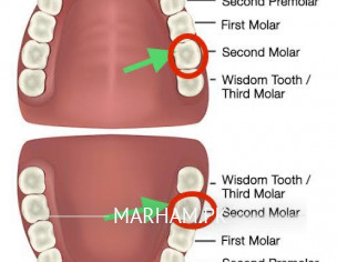 Dental Issue