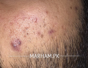 Skin Issues 