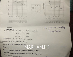Hearing Loss Issue