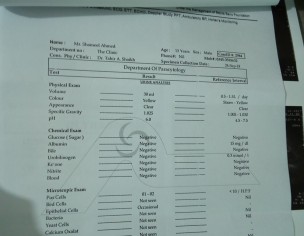 Low Platelets Count