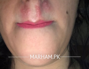 Skin Related 