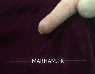 Skin Problem 