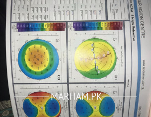 Eyesight Problem