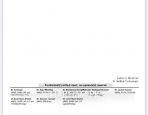 Thyroid In New Born 
