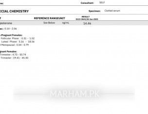 Progesterone .