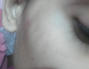 Pigmentation