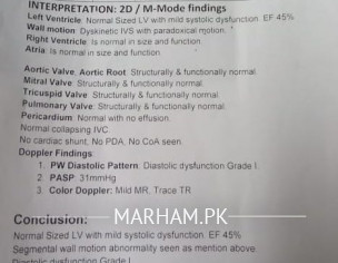 Interpret Reports