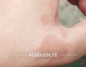 Burnt Scar