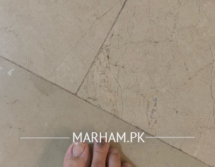 Foot Nails Issue 