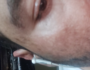 Skin Problem