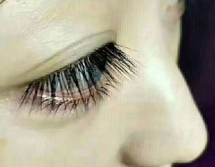 Eyelashes Problem