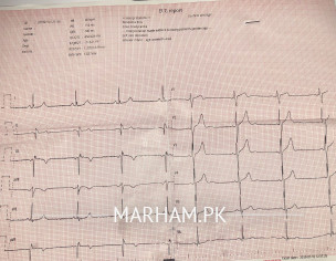 Heart Issues