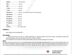 ECG