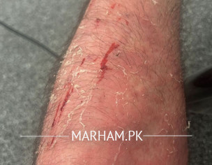 Skin Problem