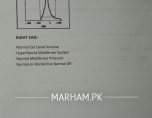 Hearing Problem