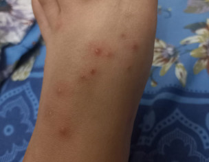 Dermatologist