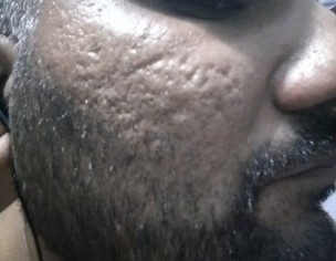 Face Docter 