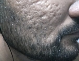Face Docter 