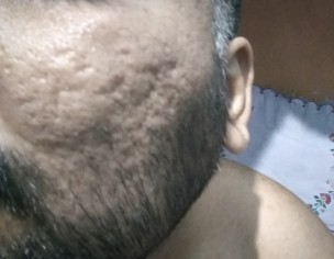 Face Docter 