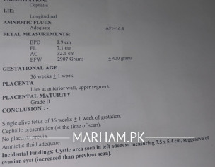 OVARIAN CYST