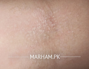 Skin Problem