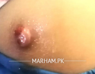 Mass Tissue