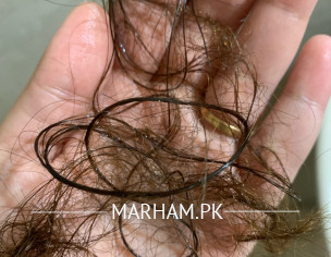 Extreme Hairfall Problem 