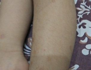 Marks