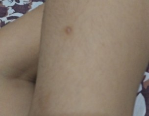 Marks