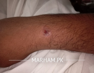 Skin Problem