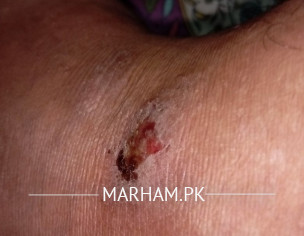 Skin Problem