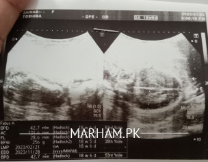 About Anoumly Scan